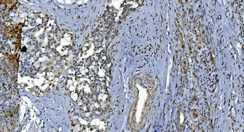 GRX2/GLRX2 Antibody