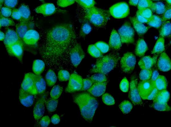 MEKK2/MAP3K2 Rabbit Polyclonal Antibody