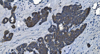 MAP4K5 Rabbit Polyclonal Antibody