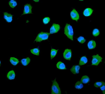 PSME2 Rabbit Polyclonal Antibody