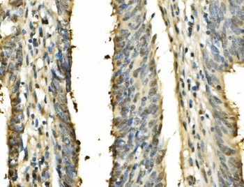 PSME2 Rabbit Polyclonal Antibody