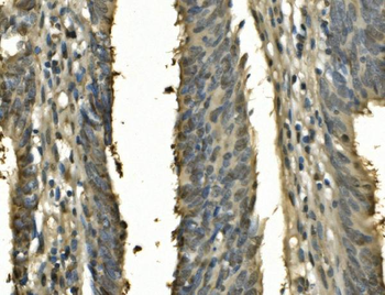 PSME2 Rabbit Polyclonal Antibody