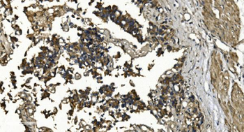 RGS6 Rabbit Polyclonal Antibody
