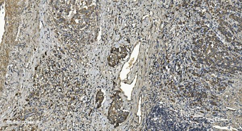 RGS6 Rabbit Polyclonal Antibody