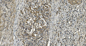RGS6 Rabbit Polyclonal Antibody