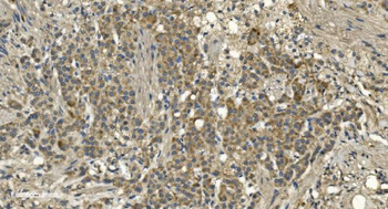 RGS6 Rabbit Polyclonal Antibody