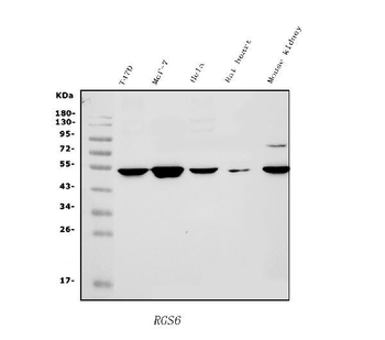 RGS6 Rabbit Polyclonal Antibody