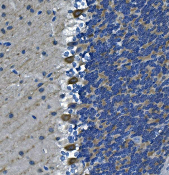 DGKZ/DGK-zeta/DGK Rabbit Polyclonal Antibody