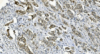 DGKZ/DGK-zeta/DGK Rabbit Polyclonal Antibody