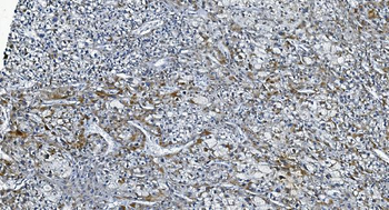 DGKZ/DGK-zeta/DGK Rabbit Polyclonal Antibody