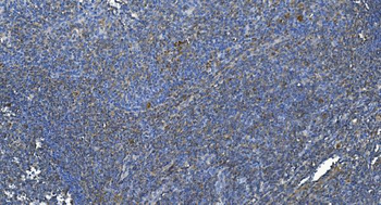 DGKZ/DGK-zeta/DGK Rabbit Polyclonal Antibody