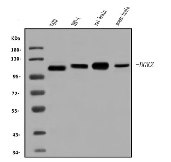 DGKZ/DGK-zeta/DGK Rabbit Polyclonal Antibody