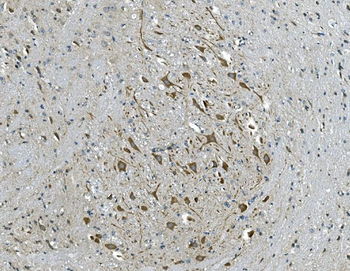 GABA A Receptor gamma 2/GABRG2 Rabbit Polyclonal Antibody