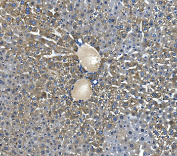 Glycine decarboxylase/GLDC Rabbit Polyclonal Antibody