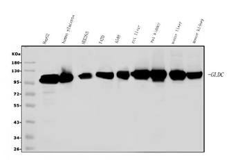 Glycine decarboxylase/GLDC Rabbit Polyclonal Antibody