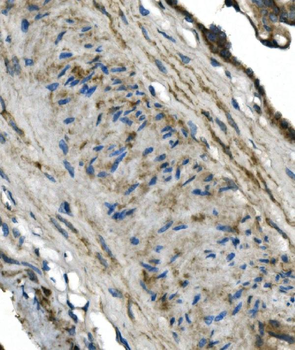 GNG4 Rabbit Polyclonal Antibody