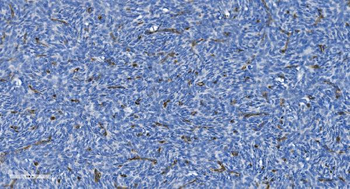 GNG11 Antibody