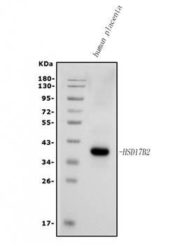 HSD17B2 Rabbit Polyclonal Antibody