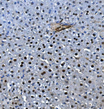 LSM5 Antibody