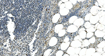 LSM5 Antibody