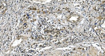 LSM5 Antibody