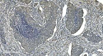 LSM5 Antibody