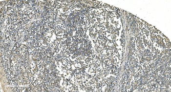 LSM5 Antibody