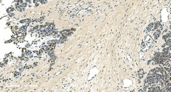 LSM5 Antibody