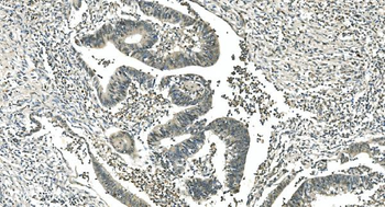LSM5 Antibody