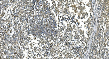 LSM7 Antibody