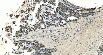 LSM7 Antibody