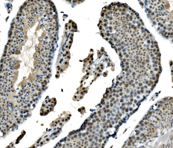LSM8 Antibody