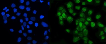 LSM8 Antibody