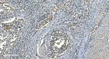 LSM8 Antibody
