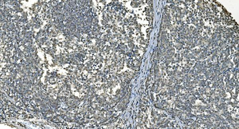 LSM8 Antibody