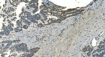 LSM8 Antibody