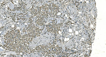 LSM8 Antibody