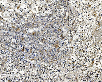 NDUFB2 Rabbit Polyclonal Antibody