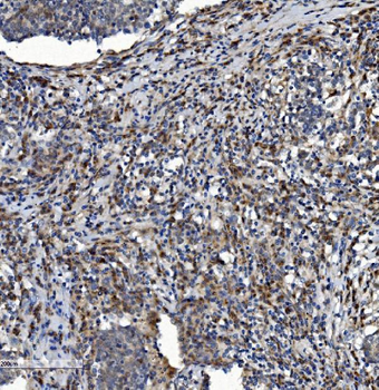 NDUFB2 Rabbit Polyclonal Antibody