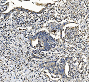 NDUFB2 Rabbit Polyclonal Antibody