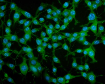 PAR4/Pawr Rabbit Polyclonal Antibody