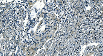 PI-16/PI16 Antibody