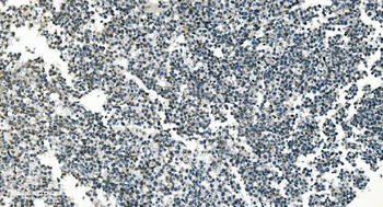 PI-16/PI16 Antibody