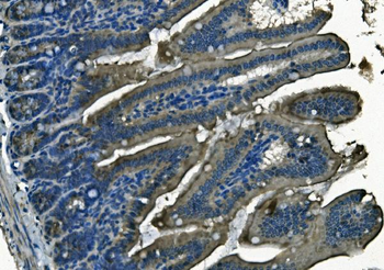 PI-16/PI16 Antibody