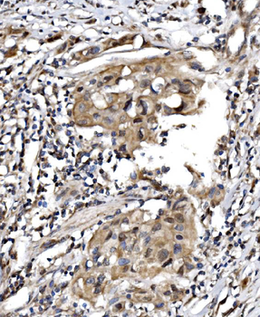 TBP-1/PSMC3 Antibody