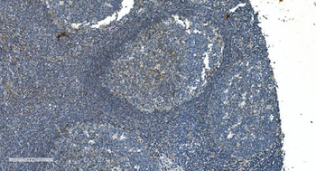 TIMM8A/DDP Antibody