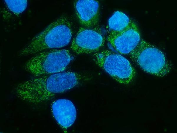 TIMM8A/DDP Antibody