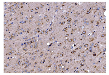 TIMM8A/DDP Antibody
