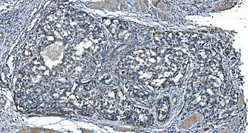 TIMM8A/DDP Antibody