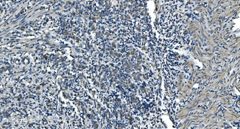 TIMM8A/DDP Antibody